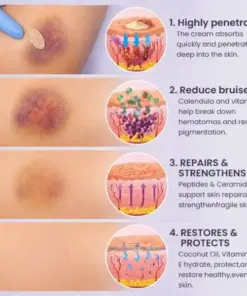 𝑴𝑹𝑬𝑽𝑩𝑺𝑰𝑵® Bruise Recovery Cream