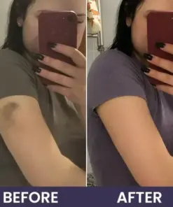 𝑴𝑹𝑬𝑽𝑩𝑺𝑰𝑵® Bruise Recovery Cream