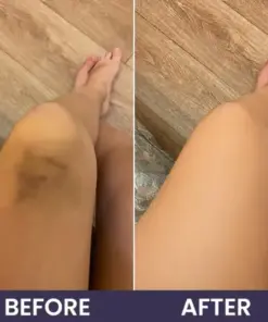 𝑴𝑹𝑬𝑽𝑩𝑺𝑰𝑵® Bruise Recovery Cream