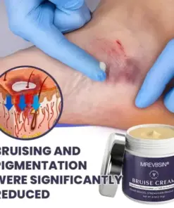 𝑴𝑹𝑬𝑽𝑩𝑺𝑰𝑵® Bruise Recovery Cream