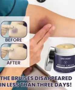 𝑴𝑹𝑬𝑽𝑩𝑺𝑰𝑵® Bruise Recovery Cream