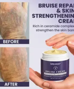 𝑴𝑹𝑬𝑽𝑩𝑺𝑰𝑵® Bruise Recovery Cream
