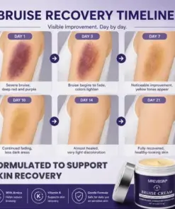 𝑴𝑹𝑬𝑽𝑩𝑺𝑰𝑵® Bruise Recovery Cream