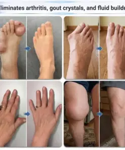 M𝐑𝐄𝐕𝐁𝑺𝑰𝑵® 0.05mm Microneedle Bone & Joint Recovery Roller